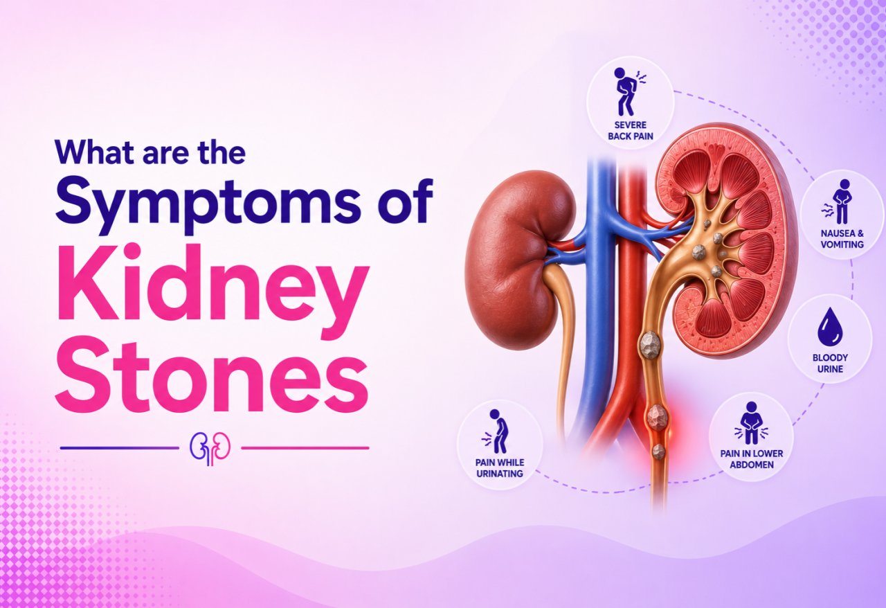 What are the Symptoms of Kidney Stones