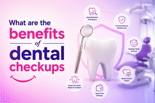 What are The Benefits of Dental Checkups